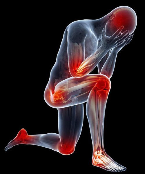 content_joint-pain-696x891-1